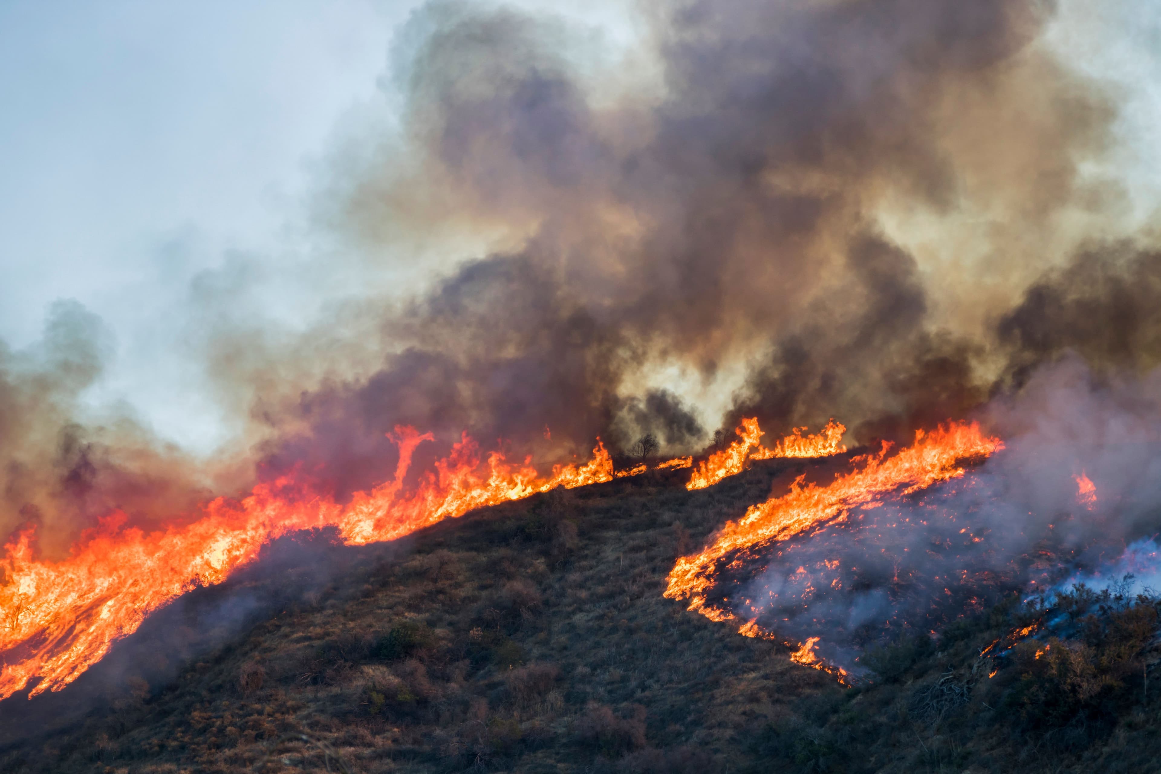 The Impact of Severe Burn Injuries