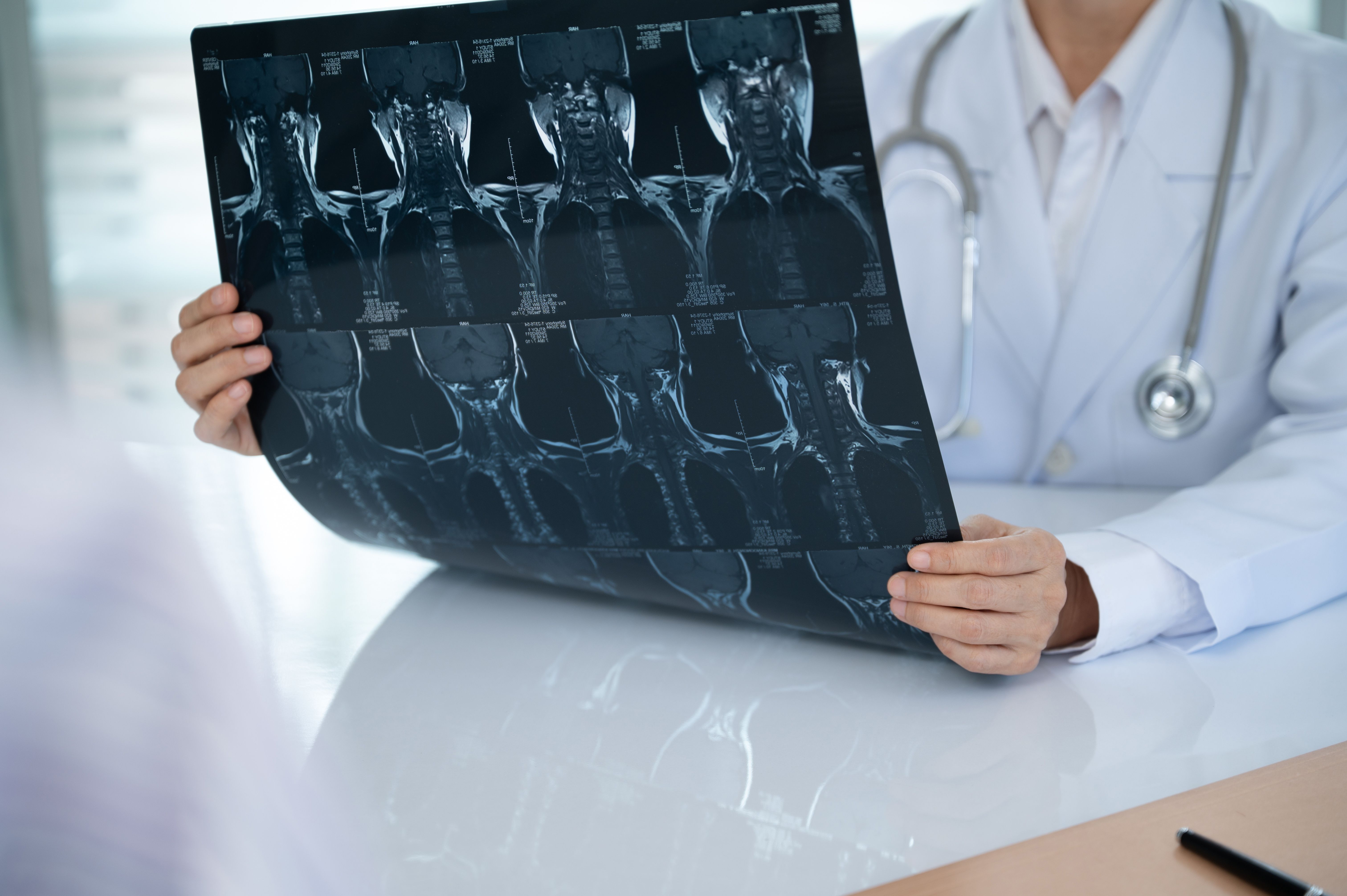 Florida Brain and Spine Injury Lawyer Moore Payne Provides